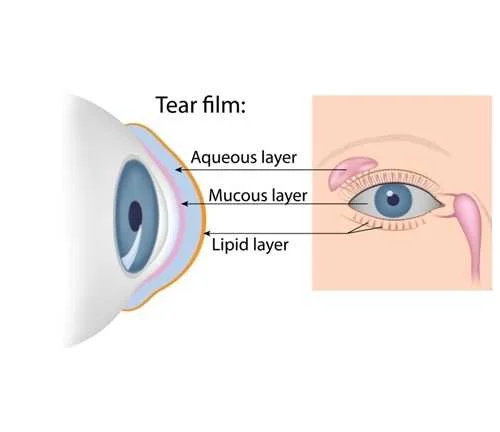 Vision Plus
